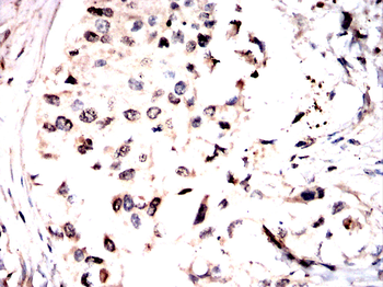 PAK2 Antibody