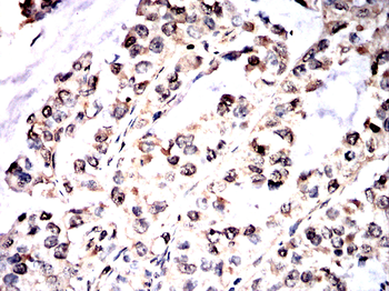 PAK2 Antibody