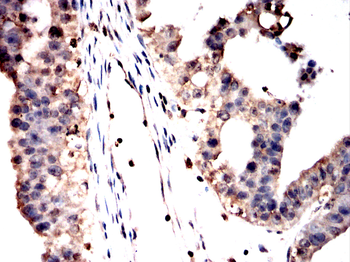 PAK2 Antibody