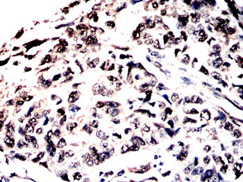 ASCL1 Antibody