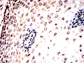 ASCL1 Antibody
