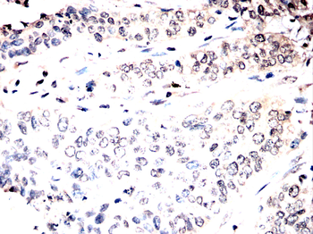 ASCL1 Antibody