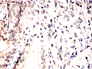 ASCL1 Antibody