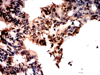 NFATC1 Antibody