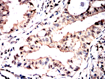 NFATC1 Antibody