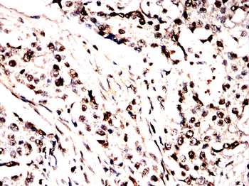 NFATC1 Antibody