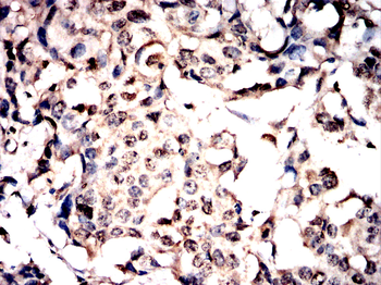 NFATC1 Antibody