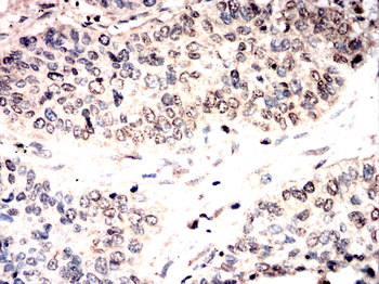 NFATC1 Antibody