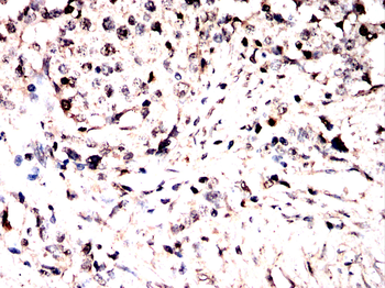 NFATC1 Antibody