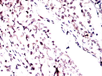 AURKA Antibody