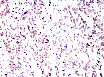 AURKA Antibody