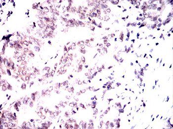 AURKA Antibody