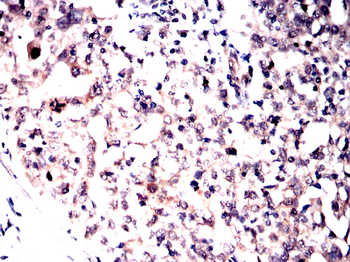 AURKA Antibody