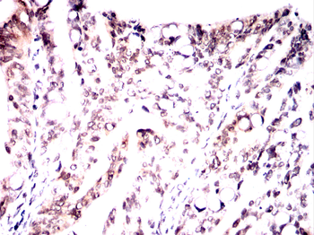AURKA Antibody