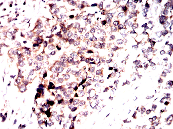 PRKAB2 Antibody