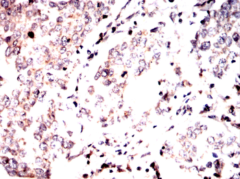 PRKAB2 Antibody
