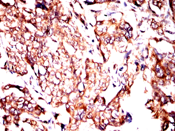 PRKAB2 Antibody