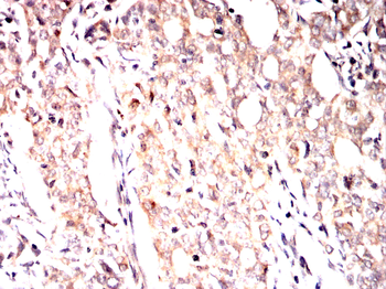 PRKAB2 Antibody