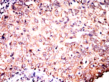 PRKAB2 Antibody
