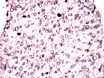 PPARG Antibody