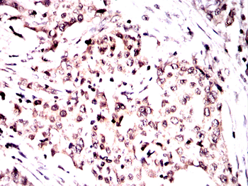 PPARG Antibody