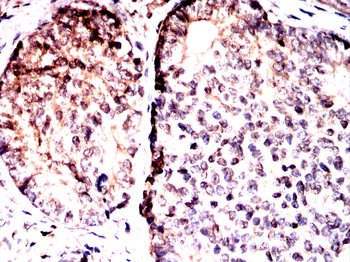 PPARG Antibody