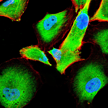 CDKN1A Antibody