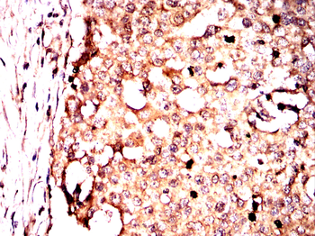 CDKN1A Antibody