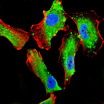 CDKN1B Antibody