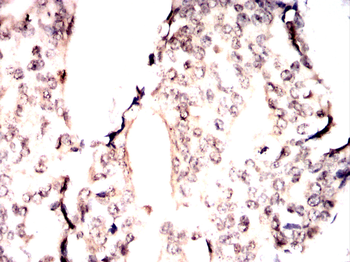 CDKN1B Antibody