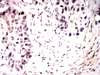 CDKN1B Antibody