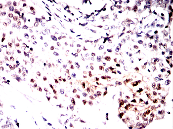 CDKN1B Antibody