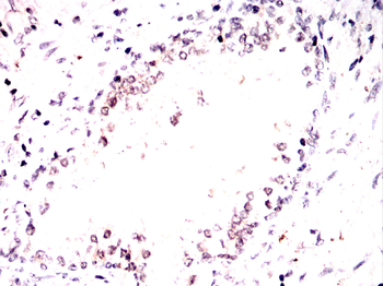 CDKN1B Antibody