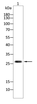 CDKN1B Antibody
