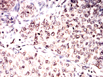 IRF3 Antibody
