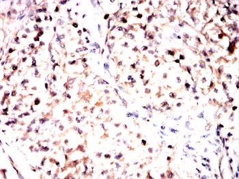 IRF3 Antibody
