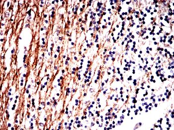 NFKBIB Antibody