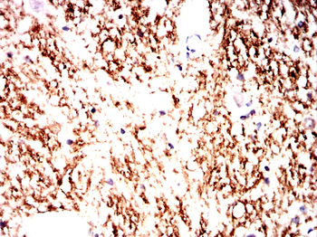 NFKBIB Antibody