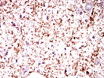 NFKBIB Antibody