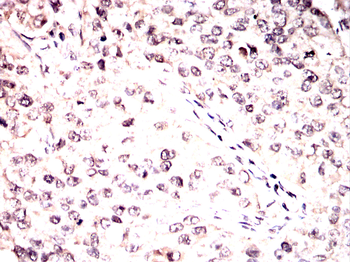 PRKAB1 Antibody