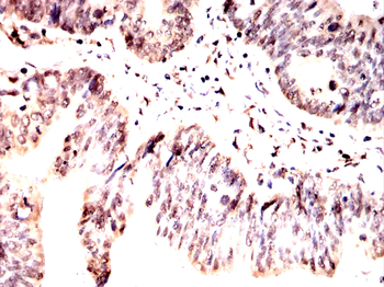 PRKAB1 Antibody
