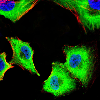 PRKAB1 Antibody