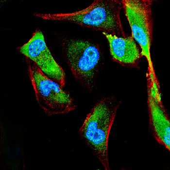JAK2 Antibody
