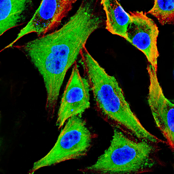 FOS Antibody