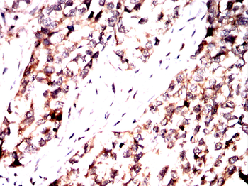 FOS Antibody