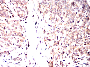 FOS Antibody