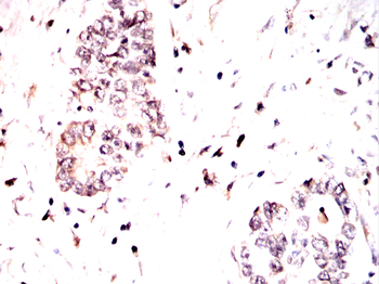 FOS Antibody