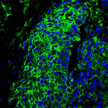 FOS Antibody
