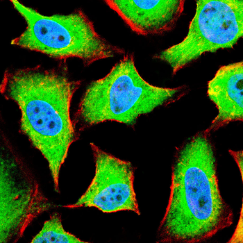 AFP Antibody