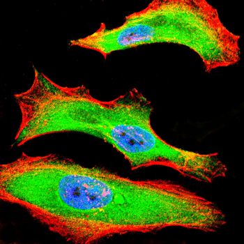 TF Antibody